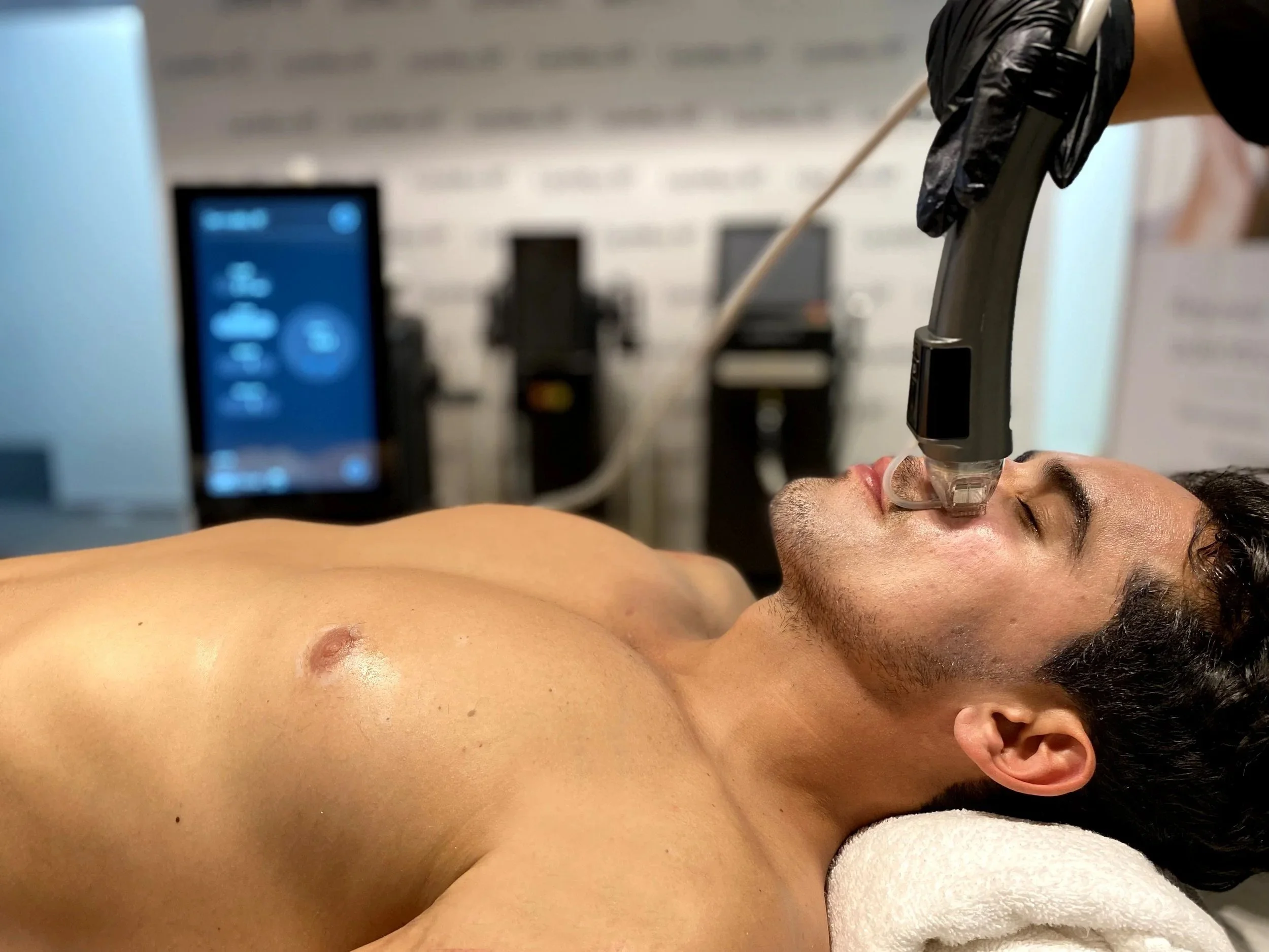 DermaMax RF treatment in progress