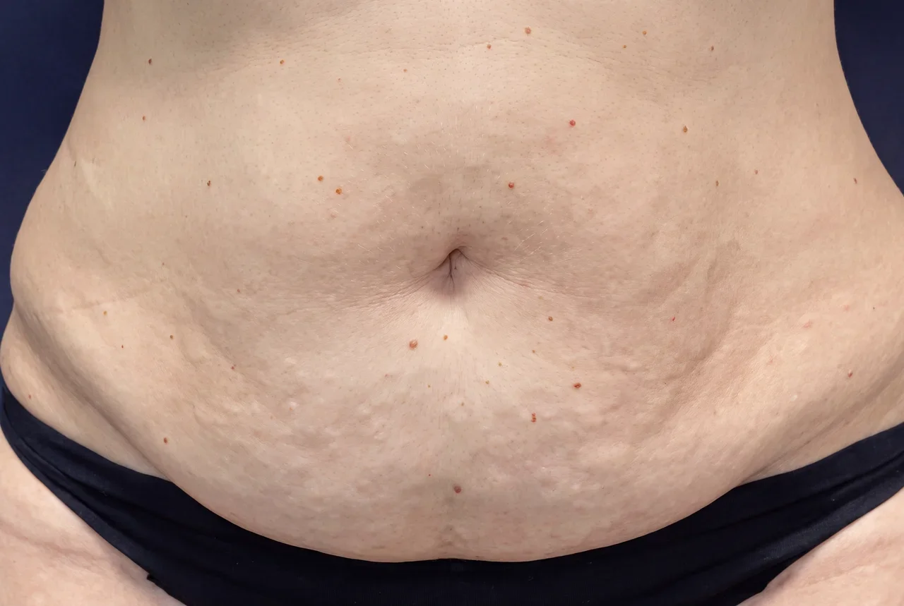 Before treatment