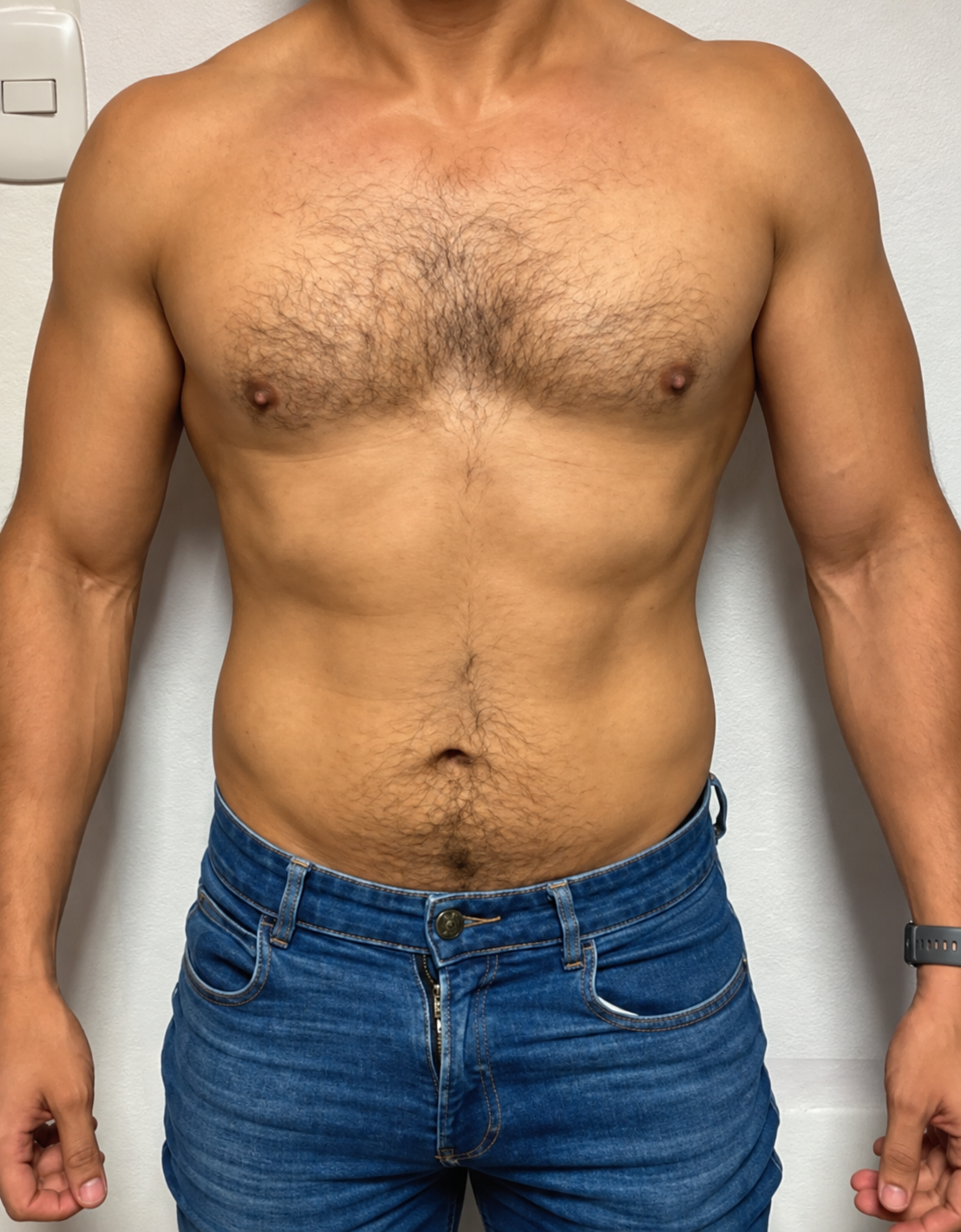 After LipoMax treatment