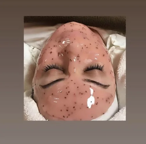 Hydrating facial before and after at Dolce Vita Aesthetics, Miami