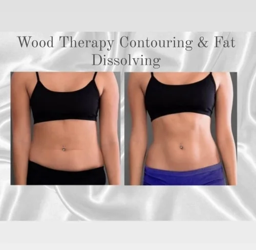 Wood therapy body sculpting before and after at Dolce Vita Aesthetics, Miami