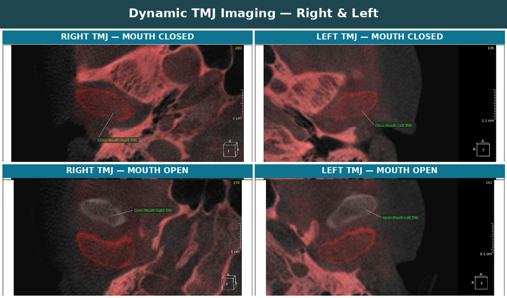 Temporomandibular joint assessment