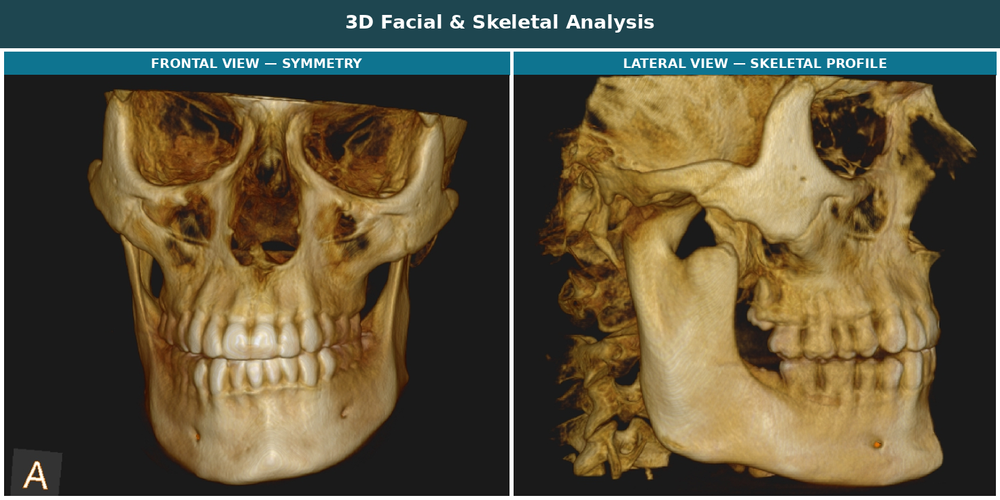 Orthodontic facial profile assessment