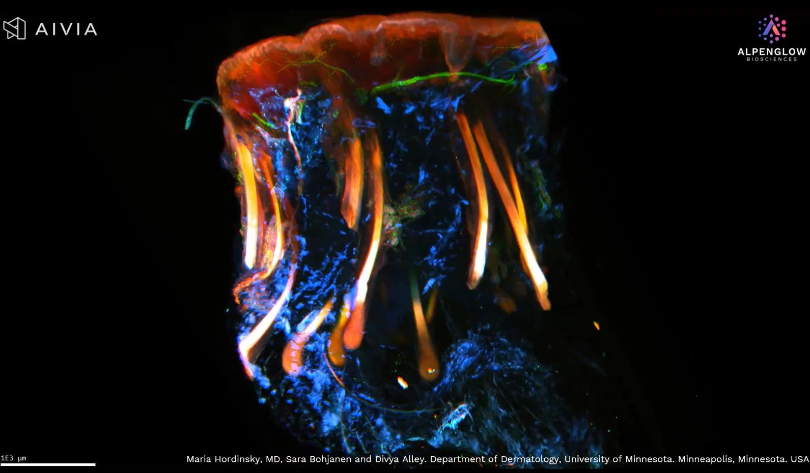 3D tissue imaging example for dermatology