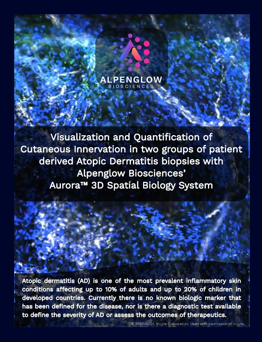 3D atopic dermatitis biopsy showing nerves, immune cells, and microvasculature