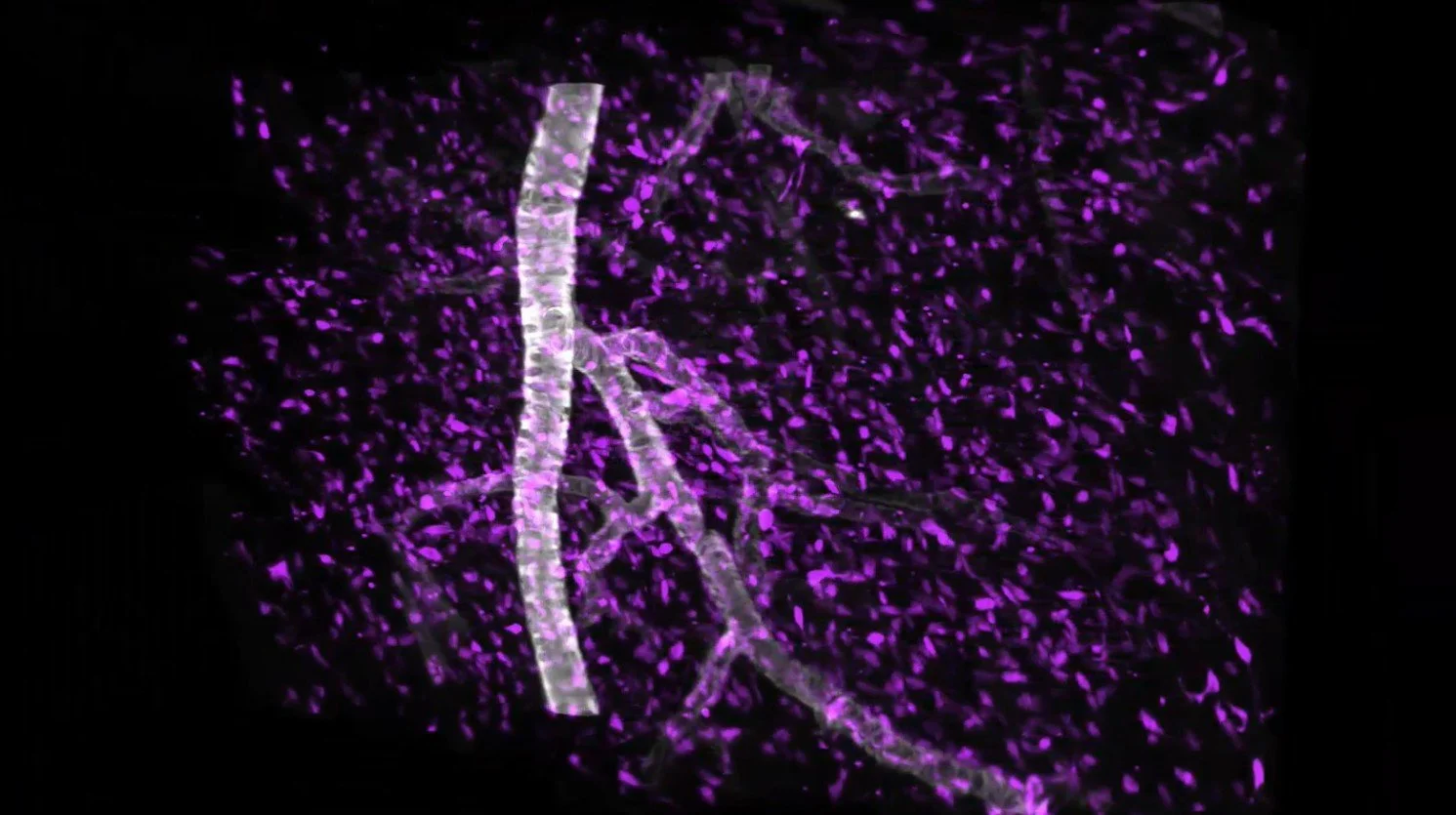 Zoom mode ROI from whole rat heart 3D tissue imaging