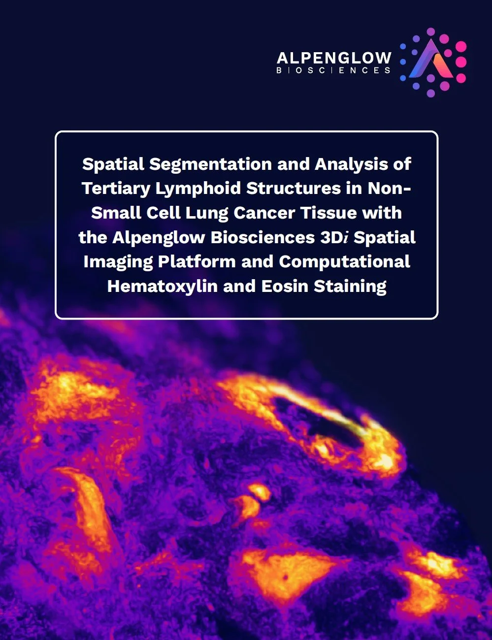 3D segmentation of tertiary lymphoid structures in non-small cell lung cancer tissue
