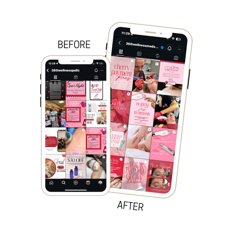 360 Wellness Med Spa Instagram grid before and after