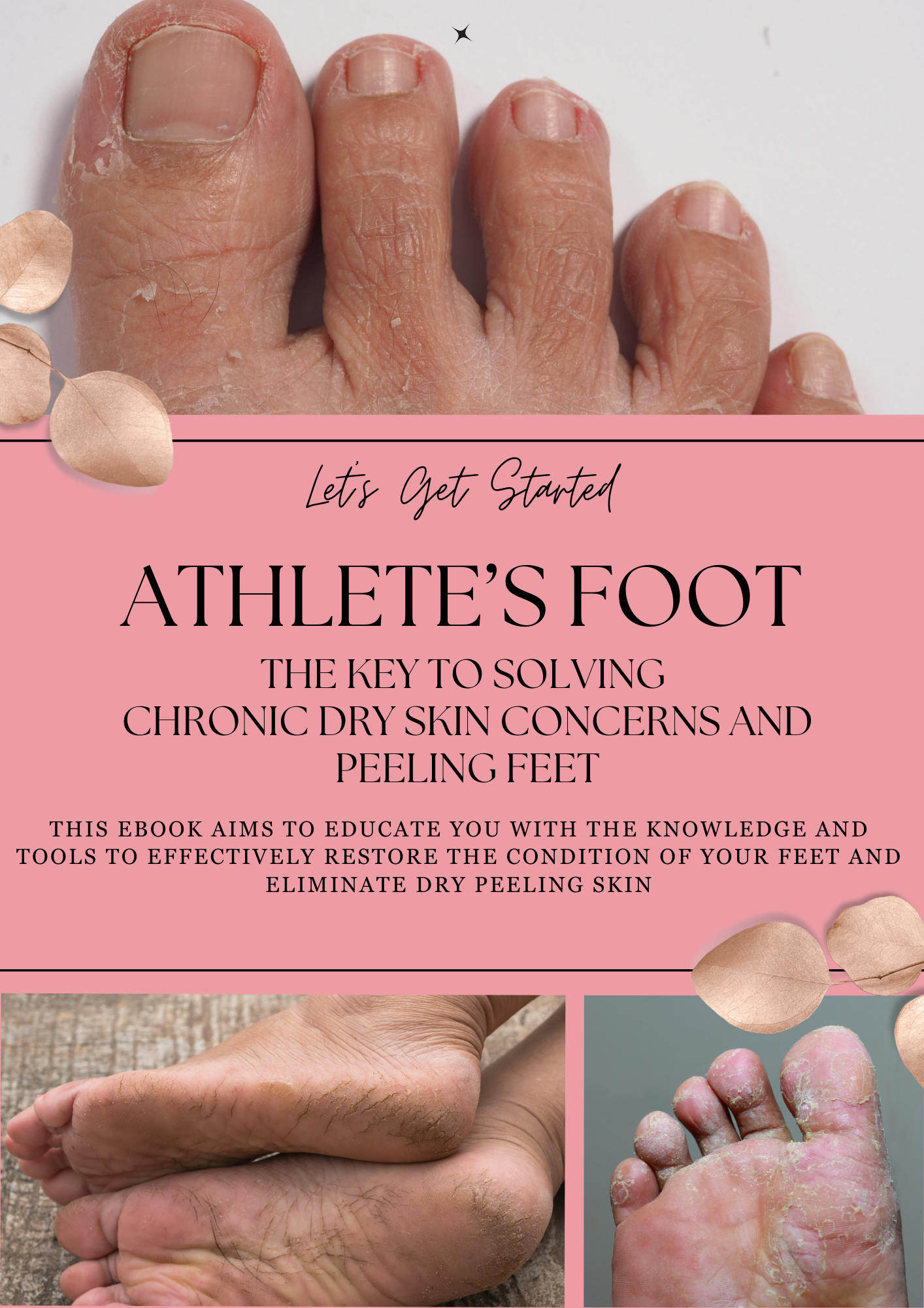 Free Athlete’s Foot Guide ebook included with the Flake-Free Foot Fix Kit
