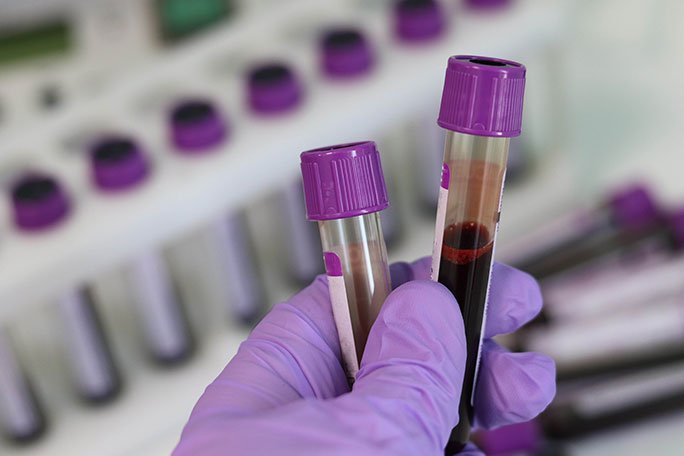a gloved hand holding two purple top tubes with blood speciments