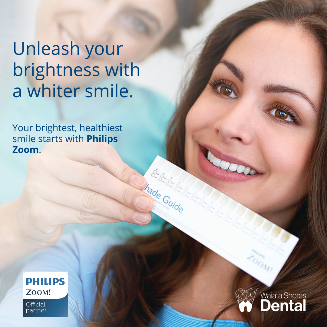 Philips Zoom Whitening result