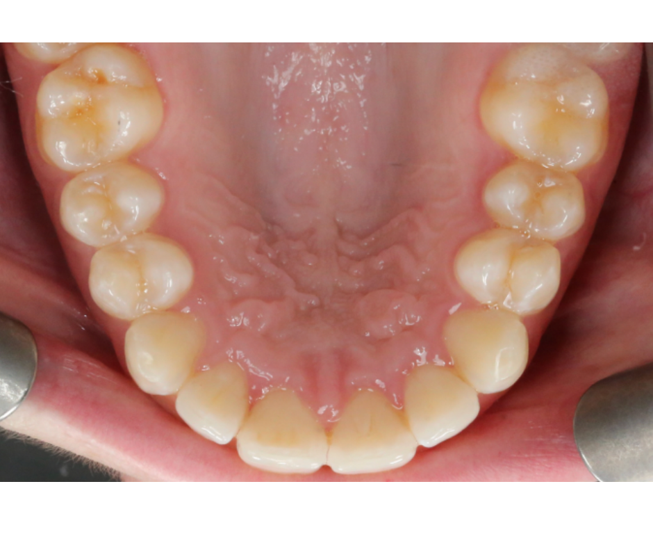 Case Study 1 view 3 after treatment