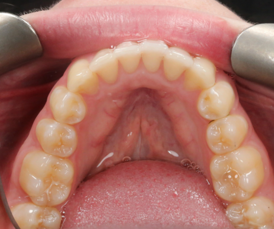 Case Study 1 view 2 after treatment