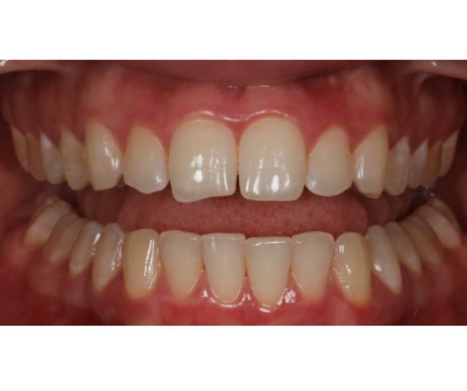 Case Study 1 view 1 after treatment