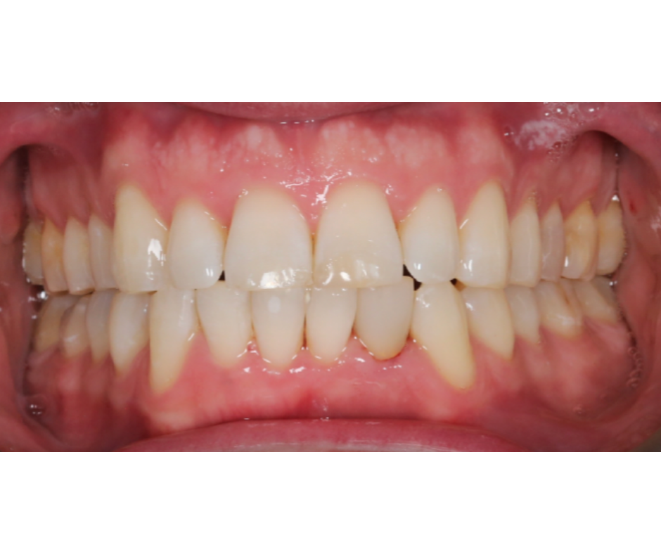 Case Study 2 view 1 after treatment