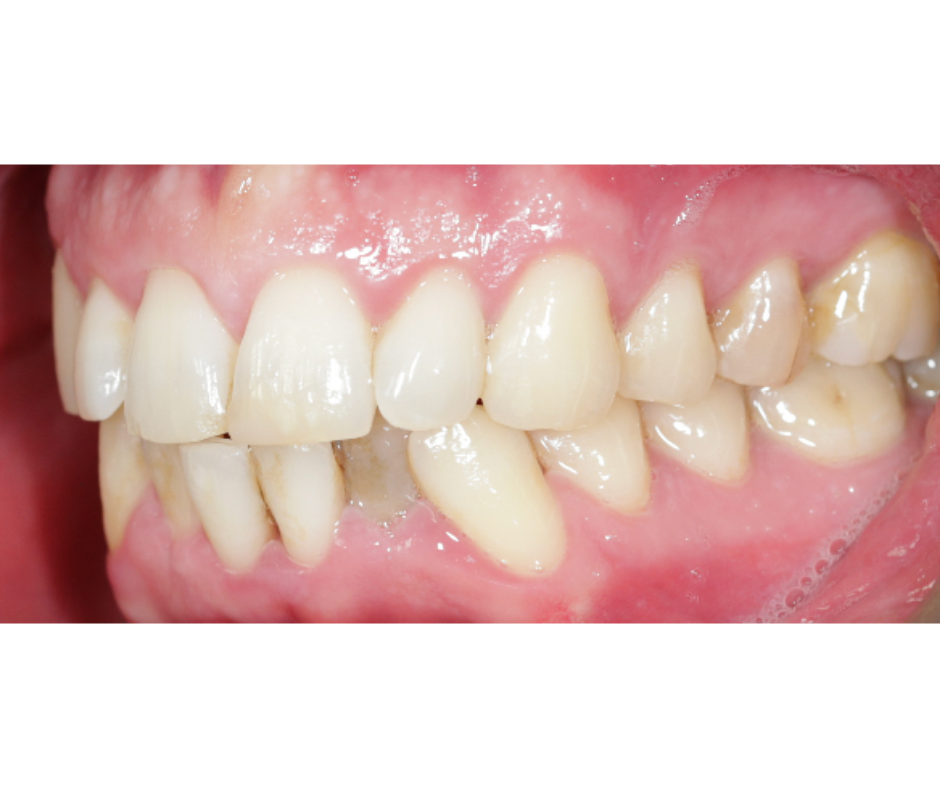 Case Study 2 view 2 before treatment