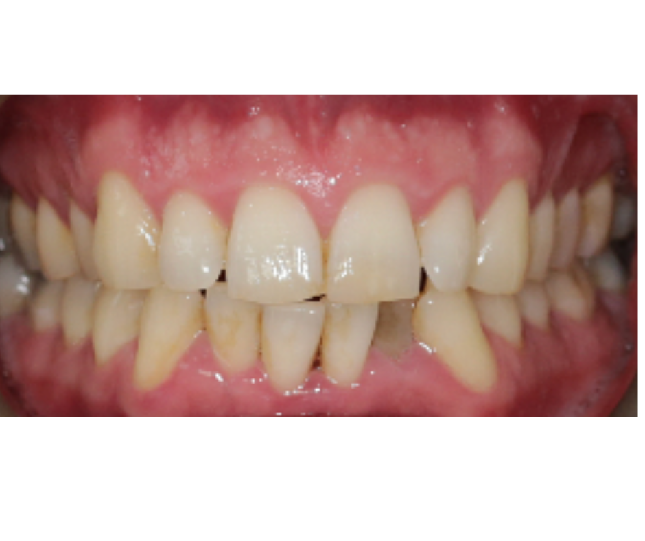 Case Study 2 view 1 before treatment