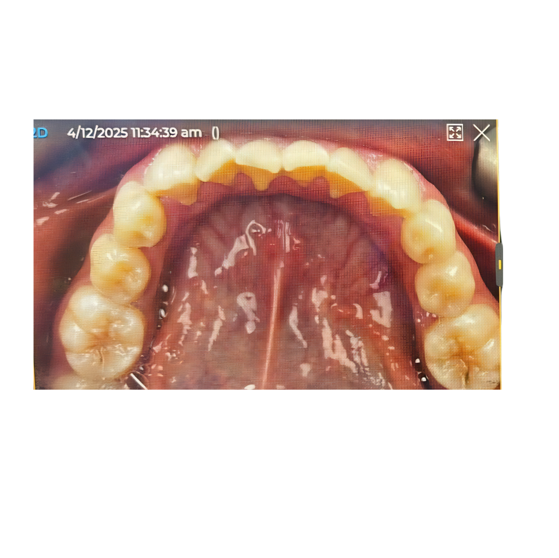 Case Study 3 view 2 before treatment