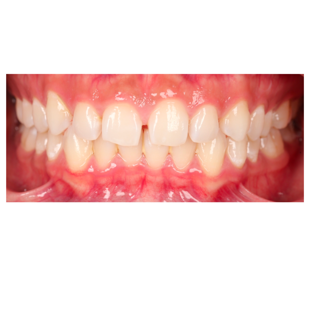 Case Study 3 view 1 before treatment