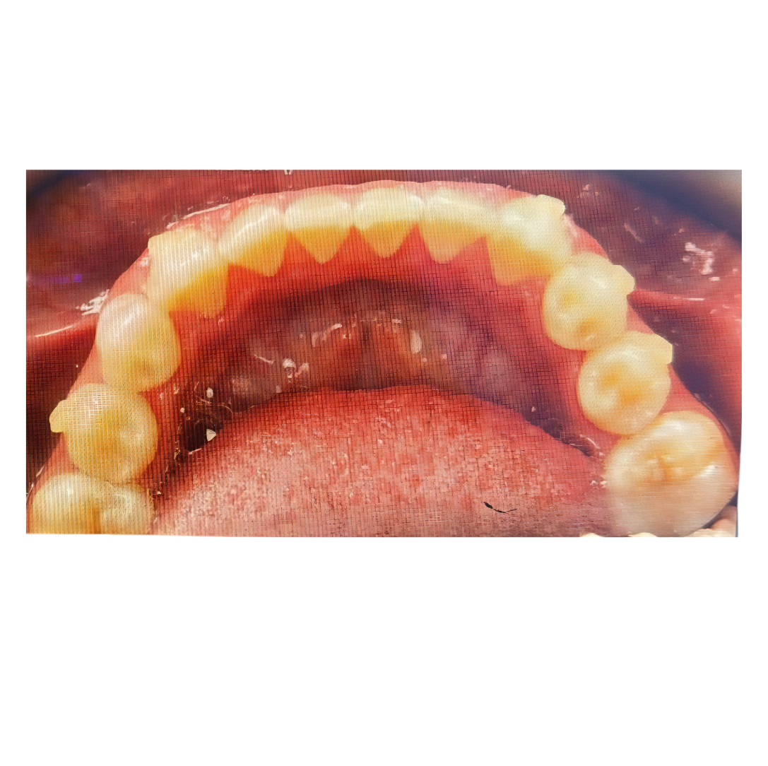 Case Study 3 view 2 after treatment