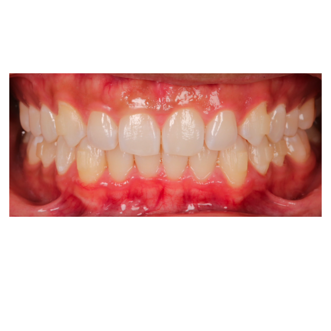 Case Study 3 view 1 after treatment