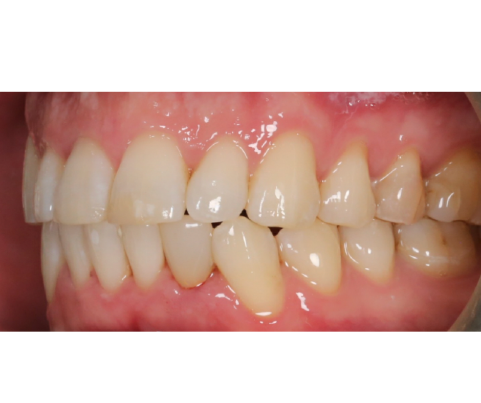 Case Study 2 view 2 after treatment