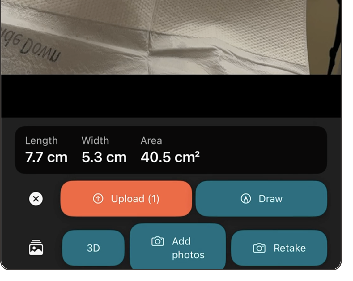 WoundScribe capture results