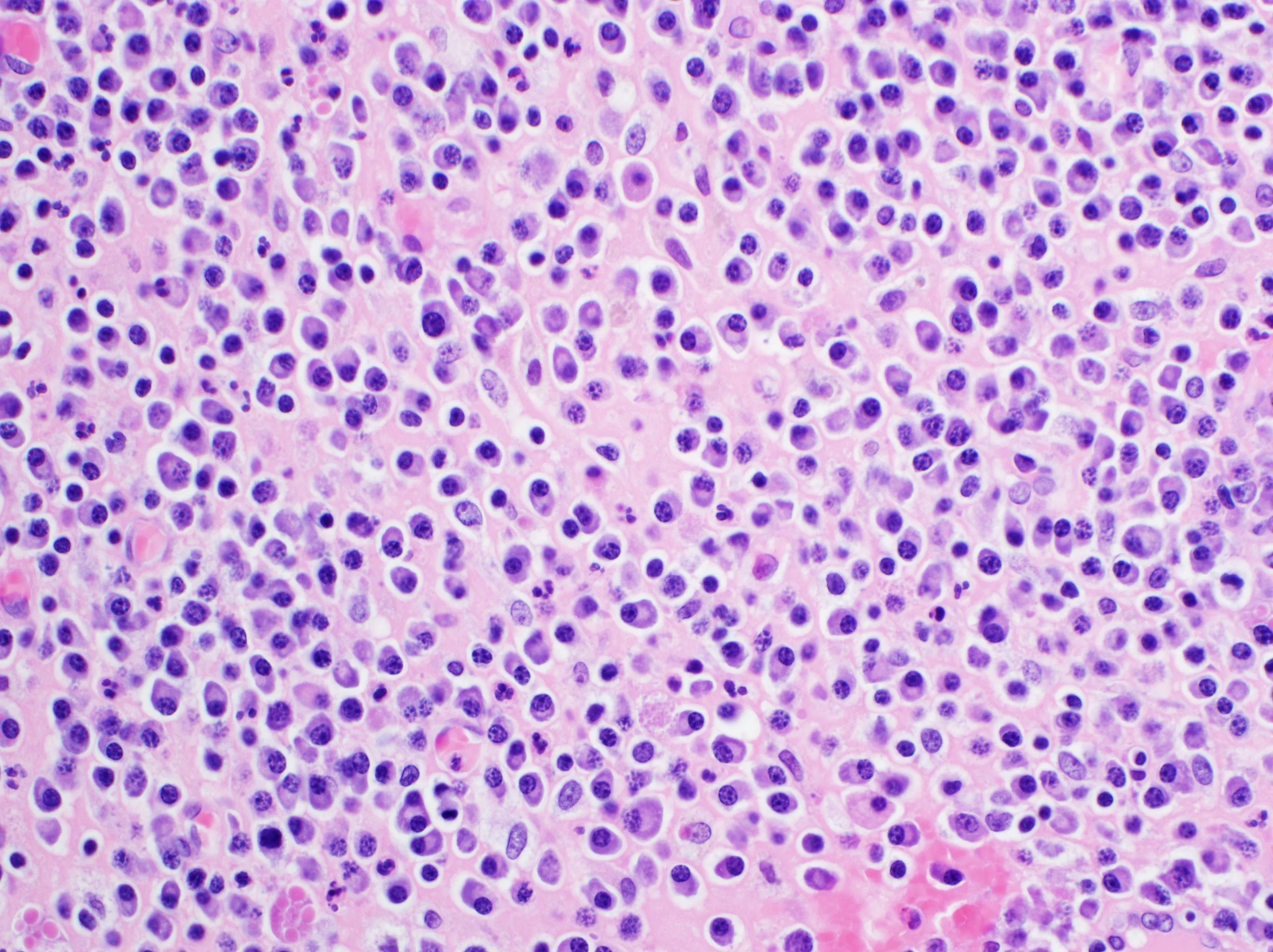 H&E stain – tissue structure