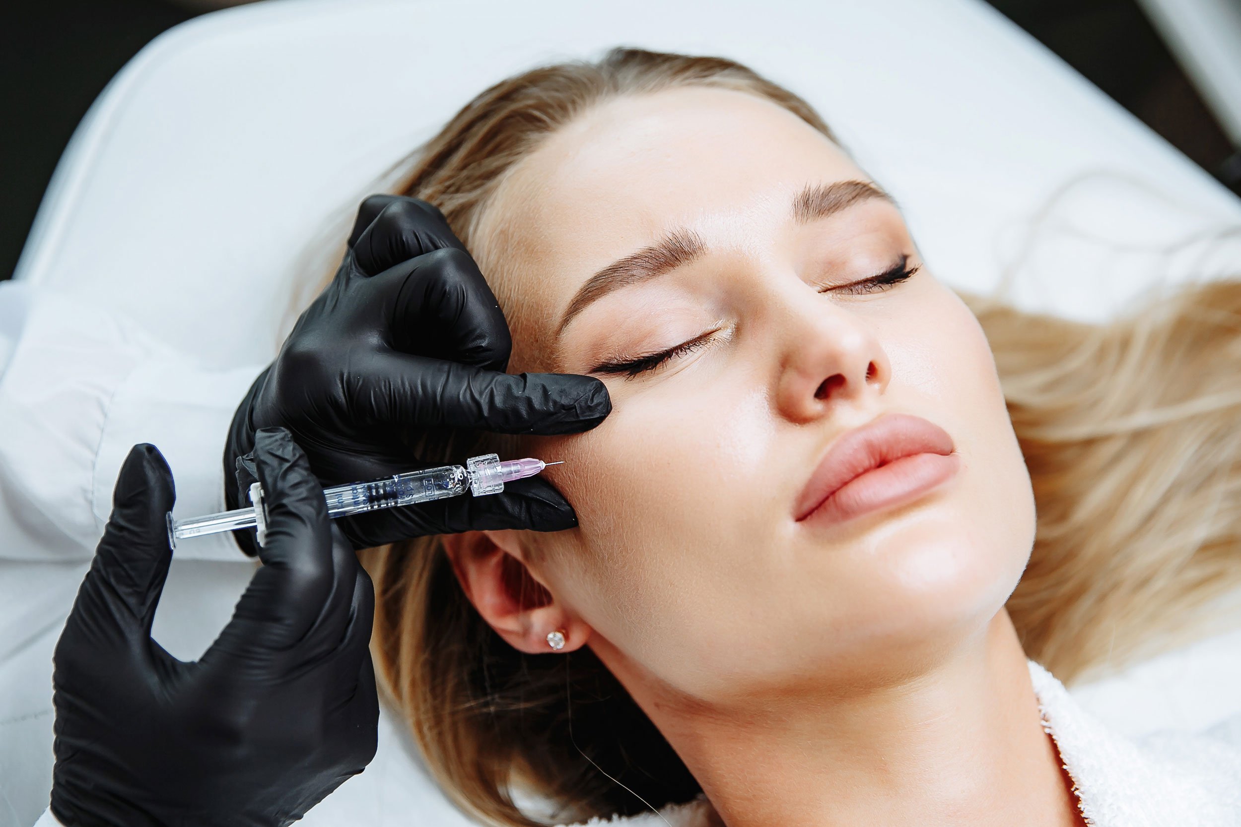 Dermal Fillers