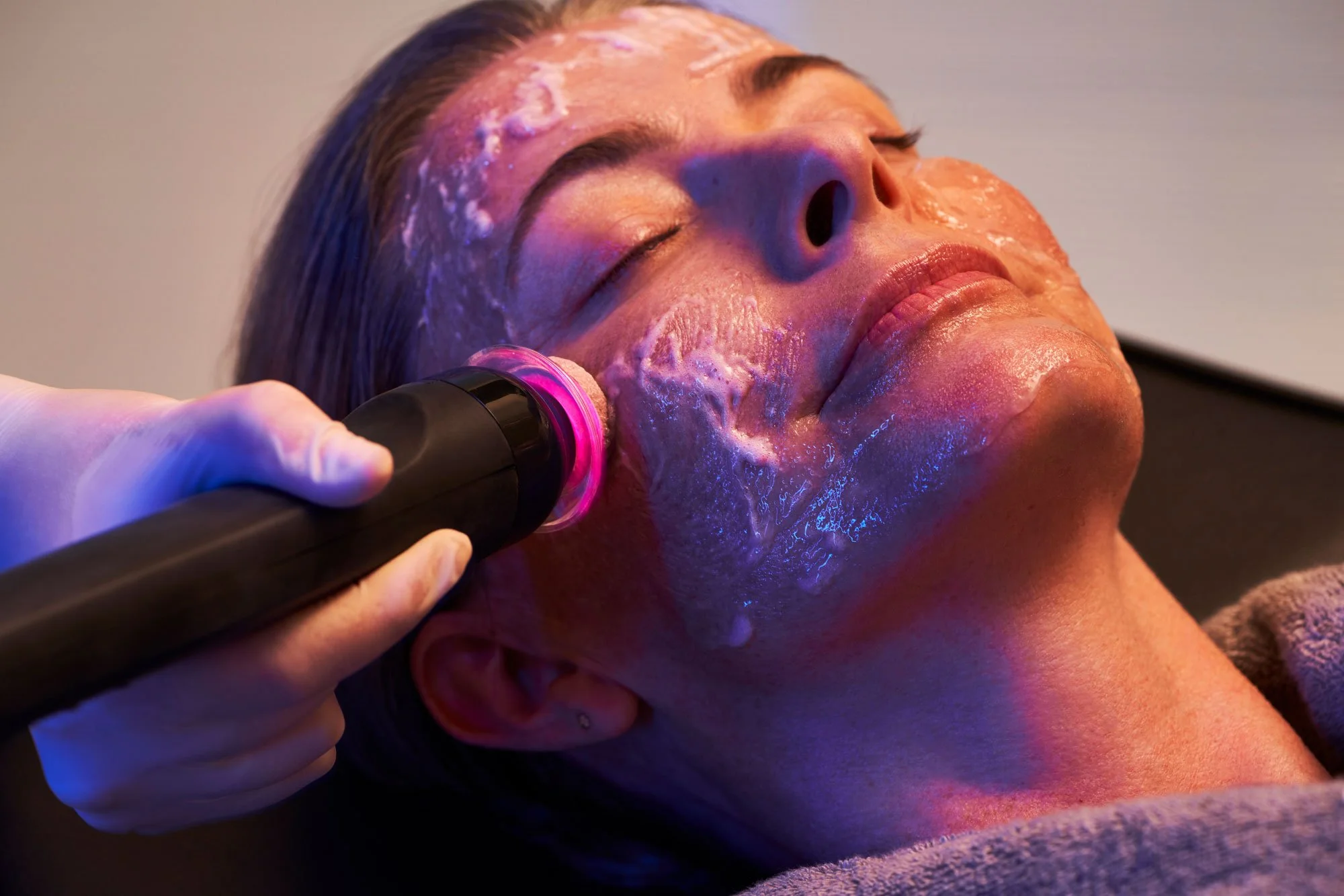 Glo2 Facial oxygenation and exfoliation treatment session