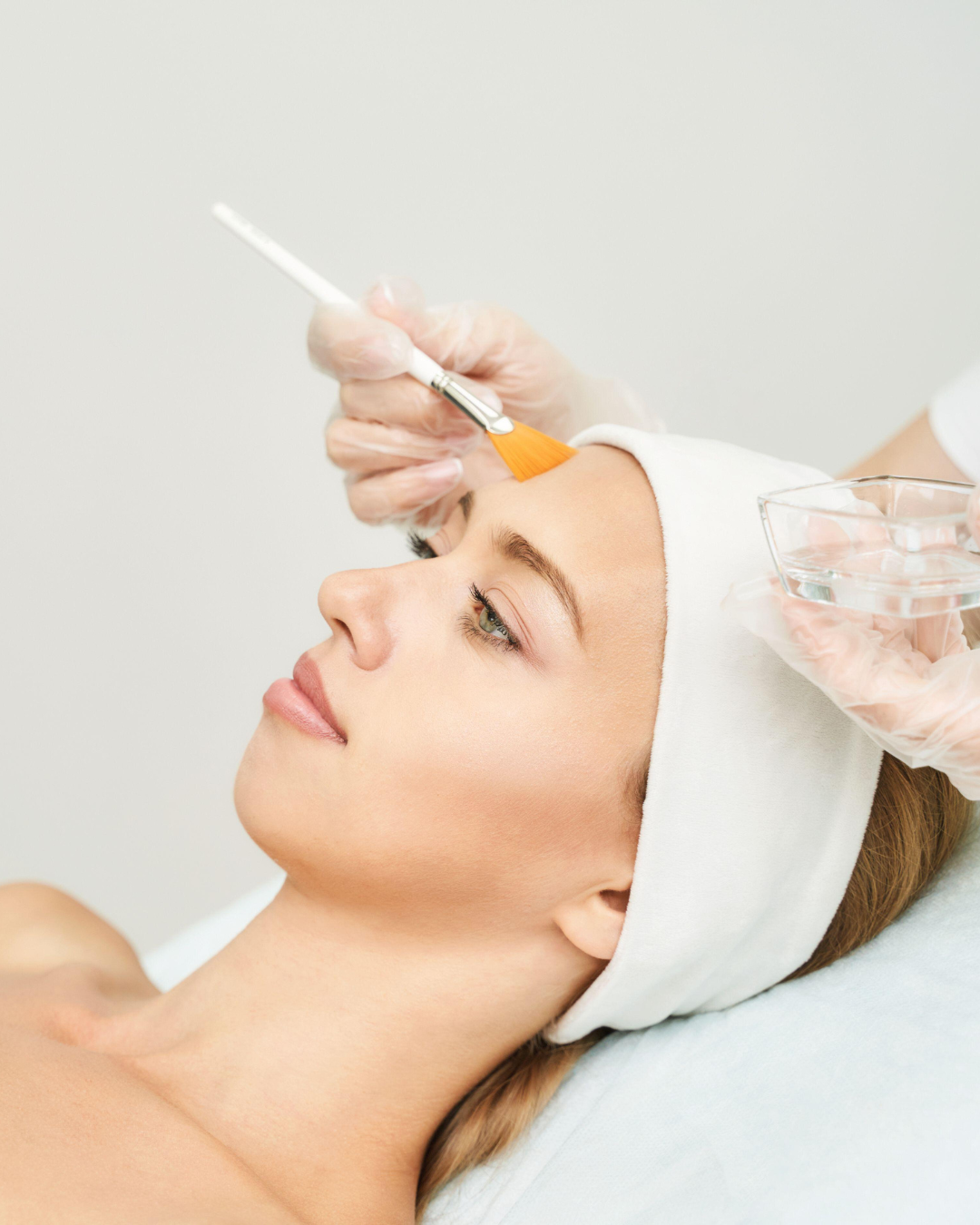 VI Peel facial clinical treatment at Evolve Skin Spa