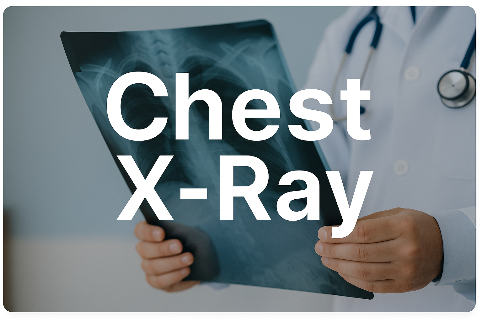 Chest X-Ray