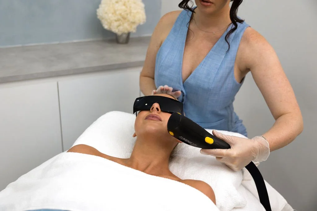 IPL pigmentation treatment at Shape of You North Perth
