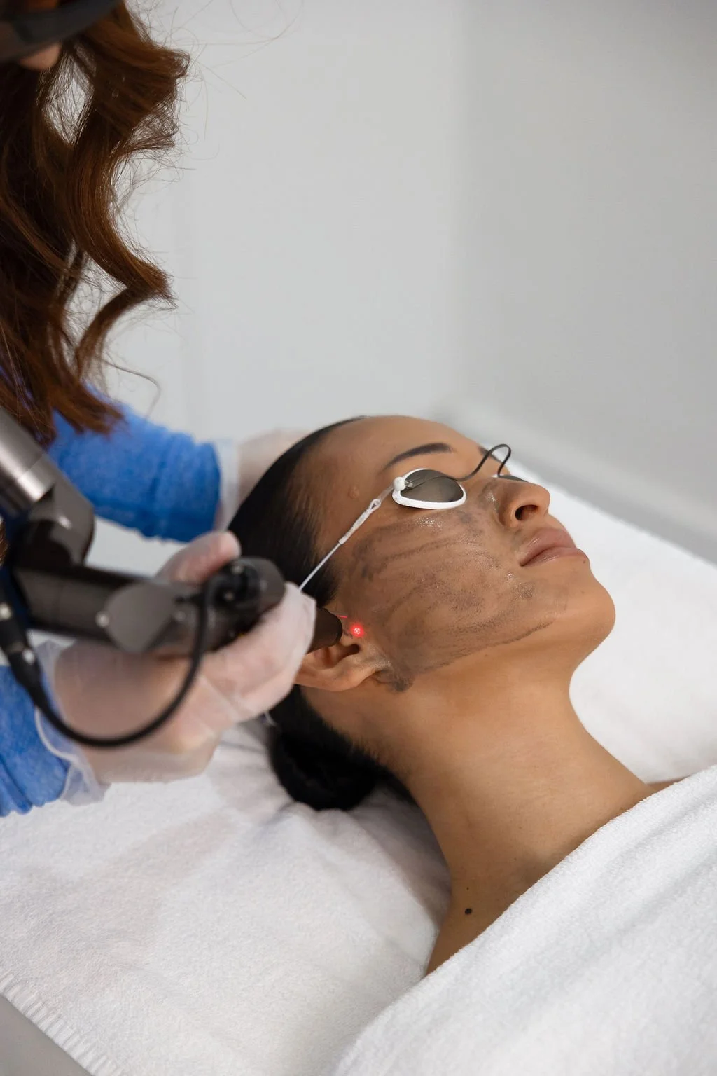 Laser treatment at Shape of You North Perth