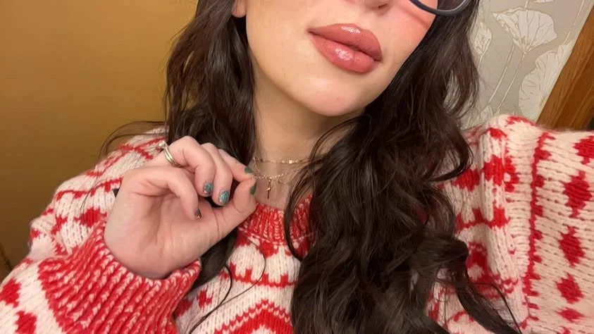 natural healed lip filler result selfie after facial balancing treatment in new berlin wi