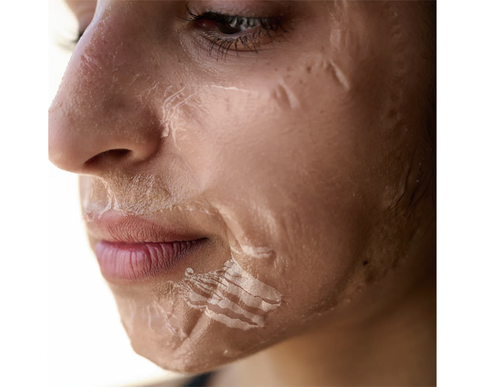 KrX Vtox mask fully hardened on client face during Advanced Oxygen Therapy Facial at A-Class Aesthetics New Berlin WI