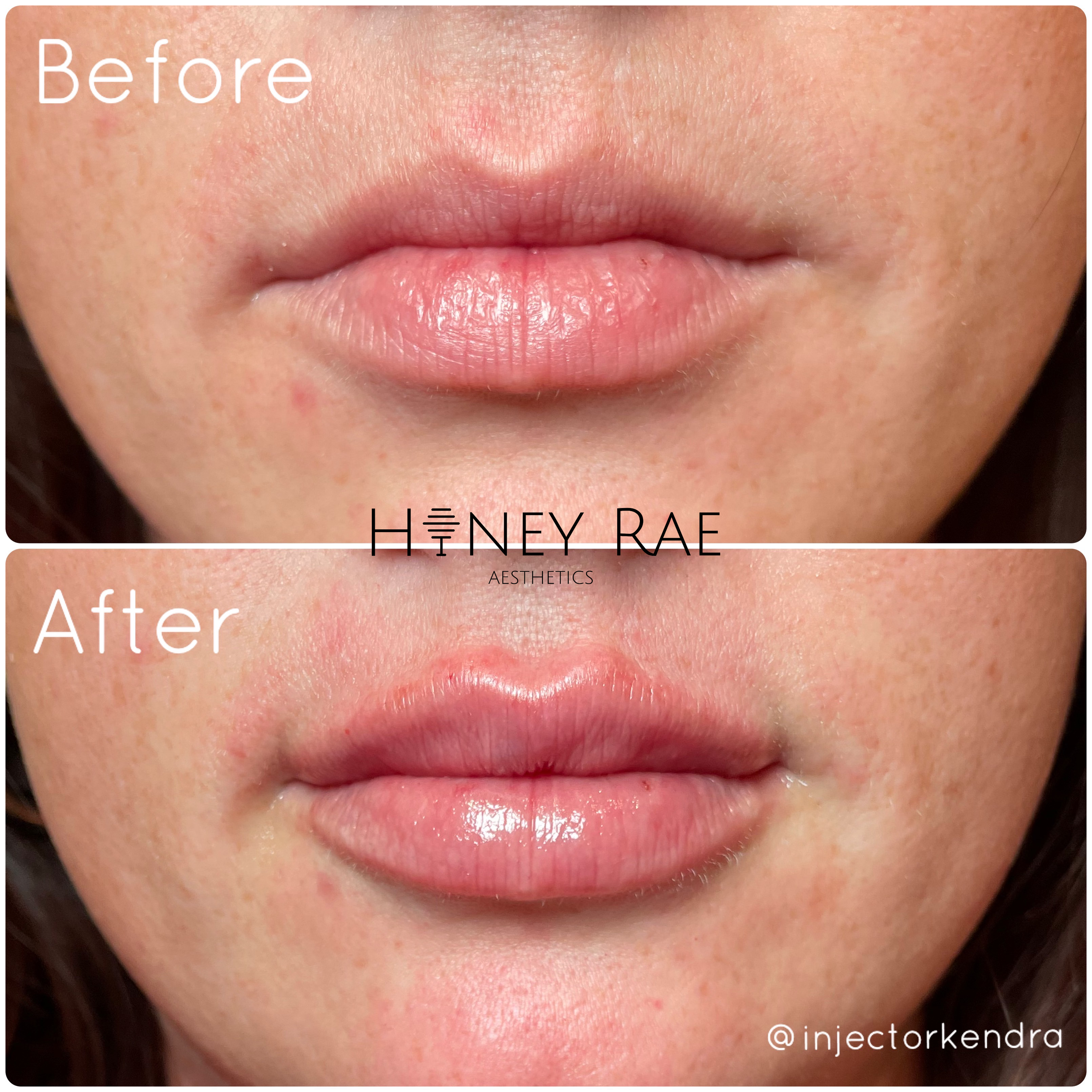 Honey Rae Lips