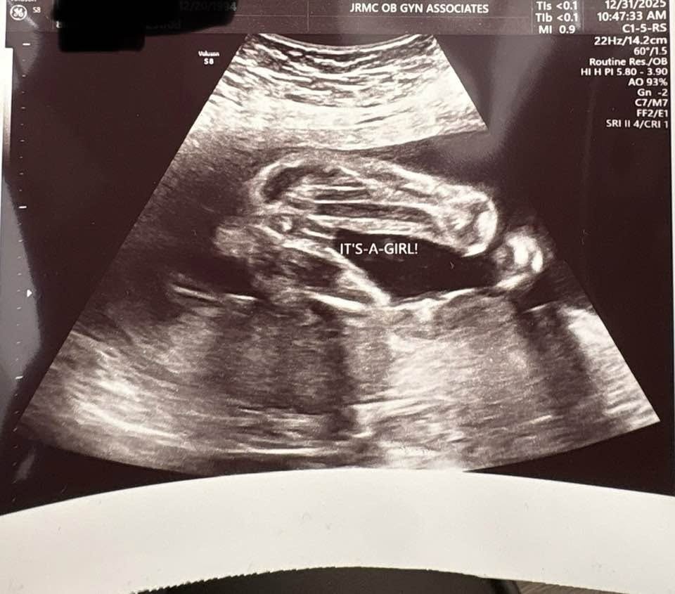 Ultrasound that says It's a girl