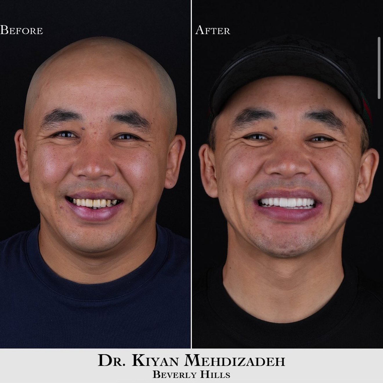 Years of damage resolved in one treatment plan