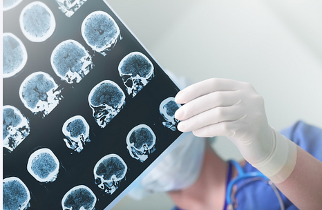 Clinician examining a series of brain scan images