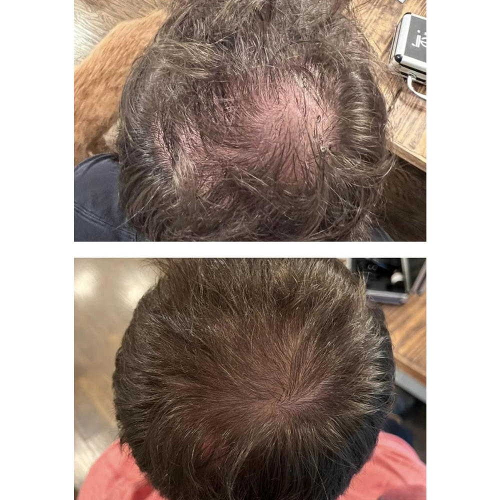 Hair rejuvenation by Kelly Frey