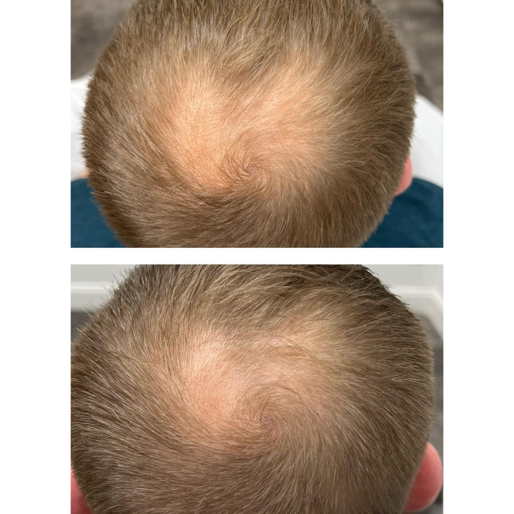 Hair rejuvenation before and after by Kelly Frey