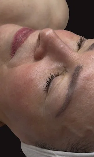 Resultado final - After