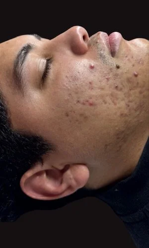 Estado original - Before