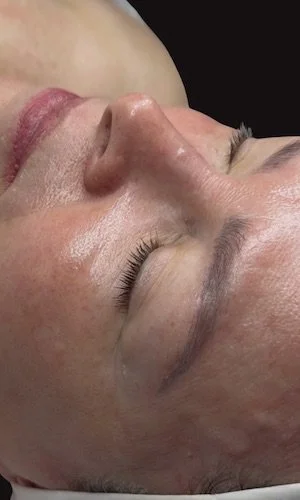 Estado original - Before