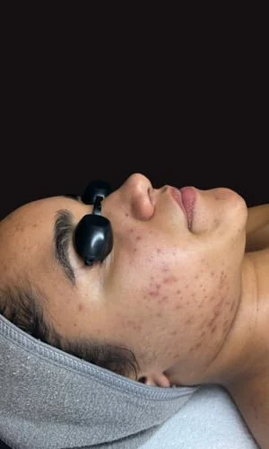 Estado original - Before