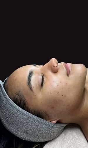 Resultado final - After