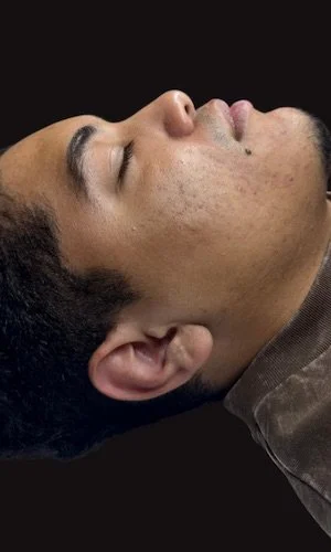 Resultado final - After