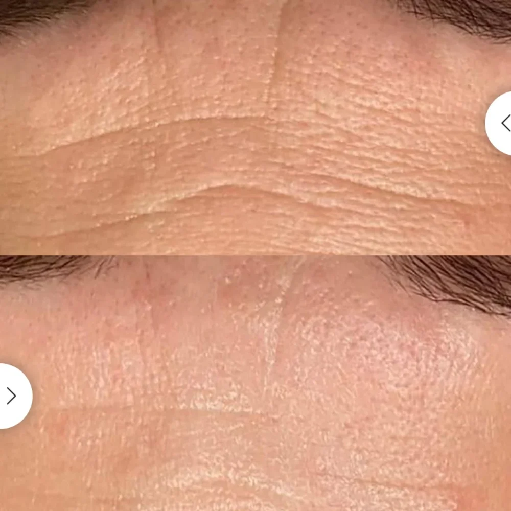 Dermalux LED therapy included complimentary at Facestellar