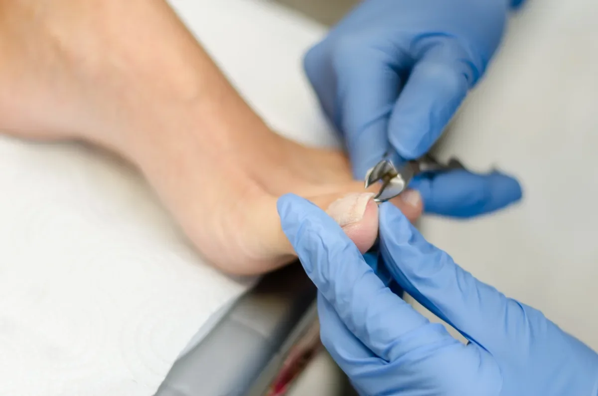 Nurse trimming a senior's toenails